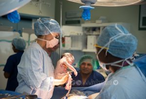 c-section operation